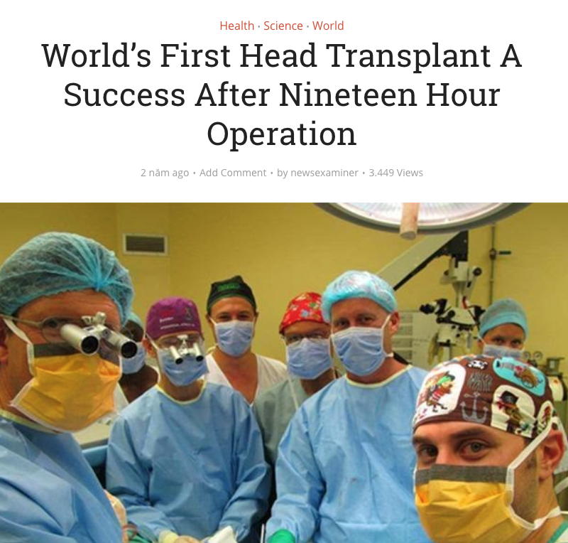 first-head-transplant-fake-news